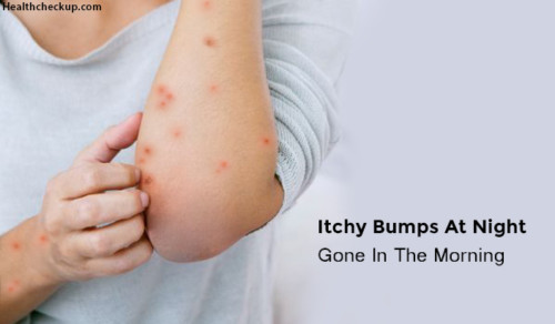 Itchy Bumps At Night Gone In The Morning Causes Symptoms Home Remedies