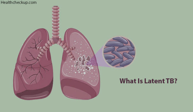 side-effects-of-latent-tb-treatment-latent-tb-treatment-duration