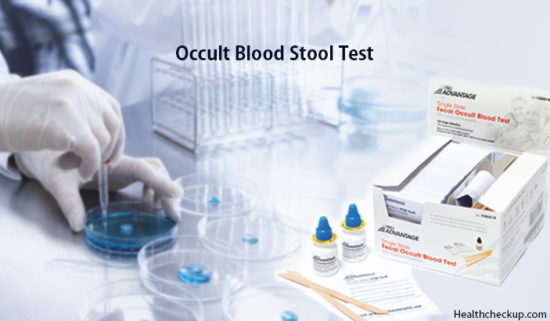 occult-blood-in-stool-test-preparation-procedure-risks-results