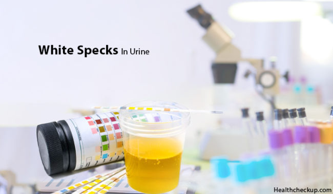 white-specks-in-urine-meaning-causes-symptoms-treatment