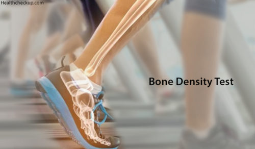 Bone Density Test Preparation Procedure Results Interpretation By Dr