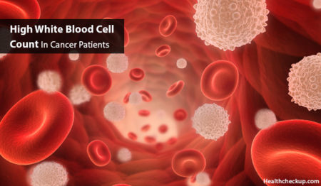 High White Blood Cells Count In Cancer Patients - Cause, Symptoms ...