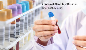 What Does Abnormal Blood Test Results Mean - Health Checkup