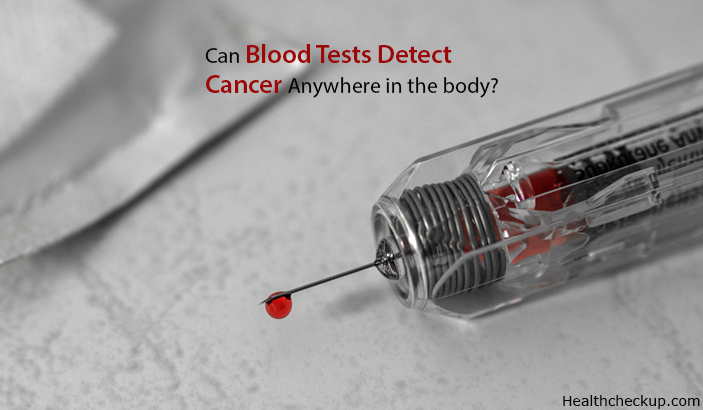 Can Blood Tests Detect Cancer Anywhere In The Body Health Checkup