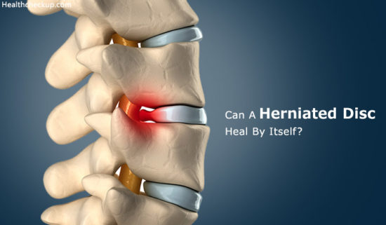 Can A Herniated Disc Heal By Itself by Dr. Himanshi