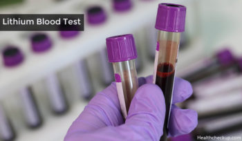 Lithium Blood Test Preparation, Procedure, Results, Side Effects