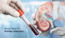 Blood Tests For Kidney Infection 250x146 
