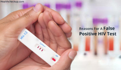 Main Reasons For a False Positive HIV Test by Dr Chathuri