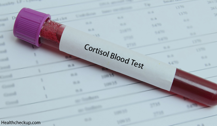 Cortisol Blood Test Fasting Instructions Procedure Results By Dr Himanshi