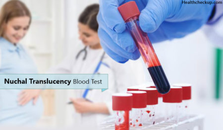 Nuchal Translucency Blood Test - Prep, Procedure, Results ...