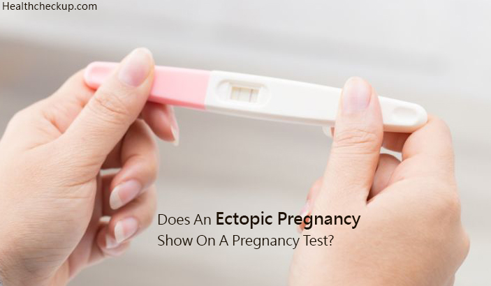 Does An Ectopic Pregnancy Show On A Pregnancy Test By Dr Himanshi