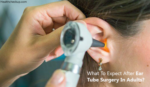 Tubes In Ears Surgery For Adults