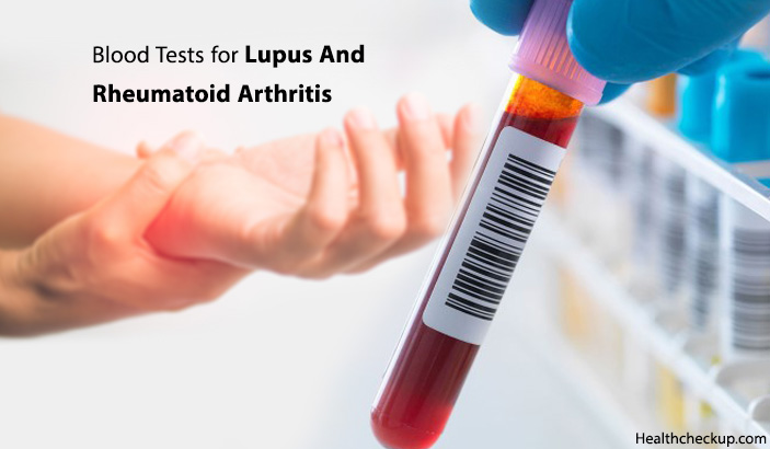 Blood Tests For Lupus And Rheumatoid Arthritis By Dr Ahmed Zayed