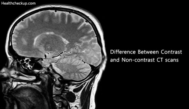 What Is The Difference Between Contrast And Non Contrast Ct Scans By Dr Adil Maqbool