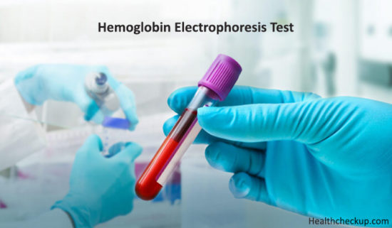 What Is Hemoglobin Electrophoresis Test By Dr Ahmed Zayed   Hemoglobin Electrophoresis Test 550x321 