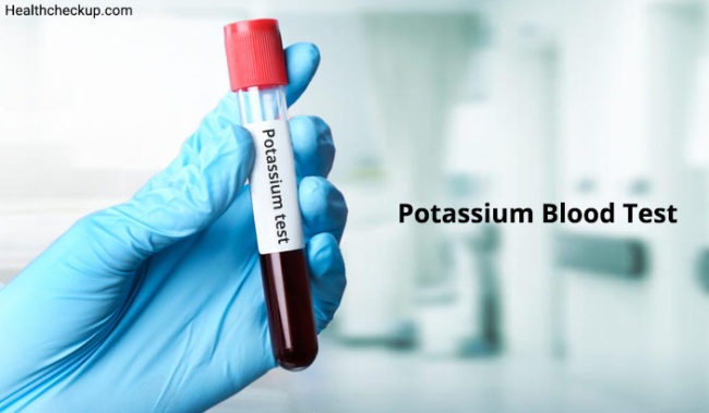 Do I Need To Fast Before A Blood Test For Potassium