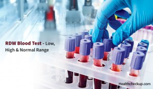 RDW Blood Test- High, Low & Normal Range By Dr. Ahmed Zayed