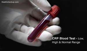 CRP Blood Test - High, Low & Normal Range By Dr. Ahmed Zayed