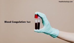 Blood Coagulation Test - Types, Diagnosis And Normal Values