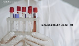 Immunoglobulin Blood Test Normal Range