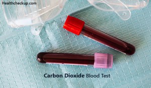 low carbon dioxide in blood