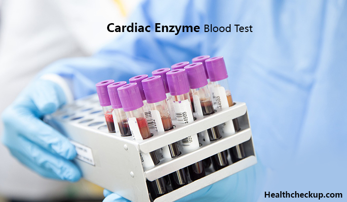 Cardiac Enzyme Blood Test Low High And Normal Values