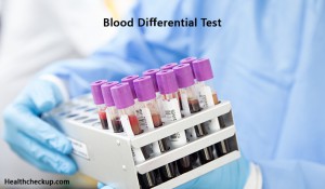 Blood Differential Test- Preparation, Procedure, And Interpretation Of ...