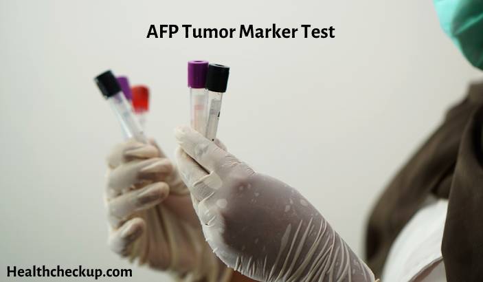 AFP Tumor Marker Test - Purpose, Preparation, Normal Range & Results