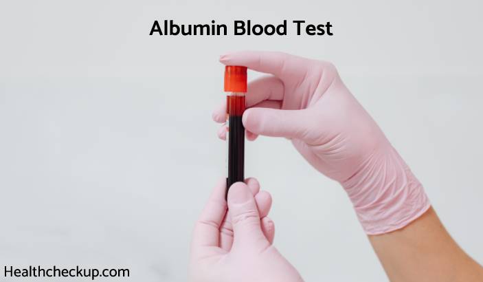 Albumin Blood Test - Low, High, Normal Range