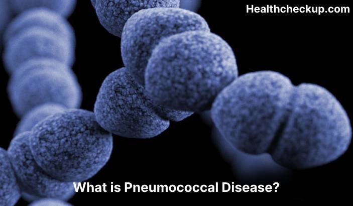 Pneumococcal disease - Symptoms, Diagnosis, Treatment, Prevention