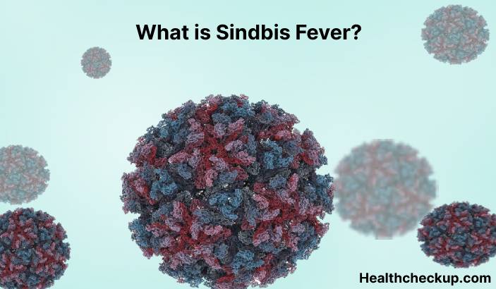 Sindbis Fever - Symptoms, Diagnosis, Treatment, Prevention