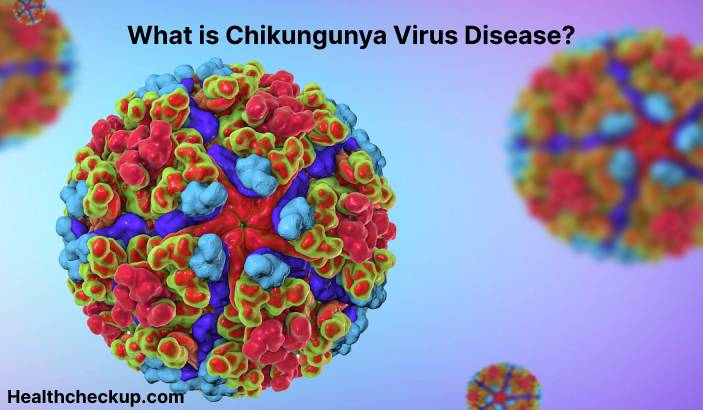 Chikungunya Virus Disease - Symptoms, Diagnosis, Treatment, Prevention