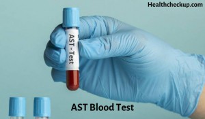 AST Blood Test: Low, High and Normal Range - Health CheckUp