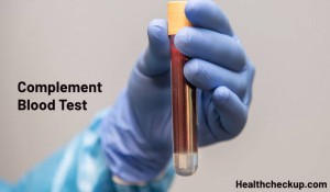 Complement Blood Test: Types, Purpose, Preparation, and Results