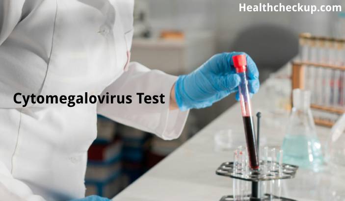 Cytomegalovirus Test - What is it, Purpose, Normal Range and Results