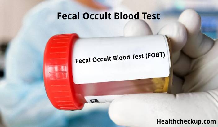 Understanding The Fecal Occult Blood Test Fobt A Comprehensive Guide Health Checkup