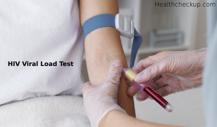 HIV Viral Load Test