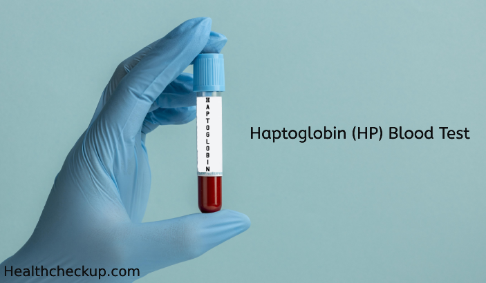 Haptoglobin Test