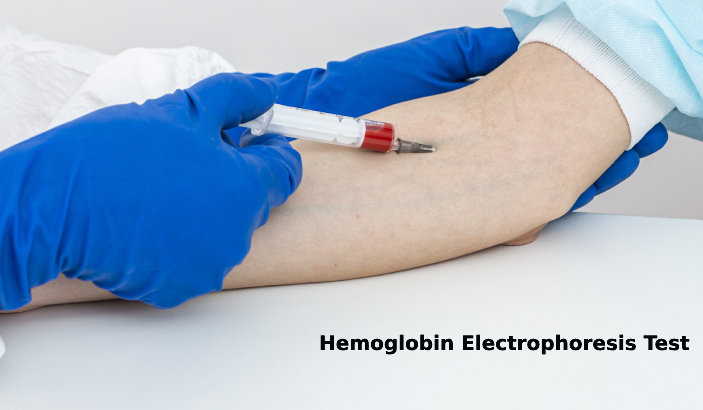 Hemoglobin Electrophoresis Test