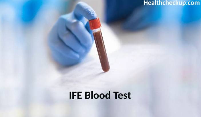 IFE Blood Test: Purpose, Preparation, Procedure, Results