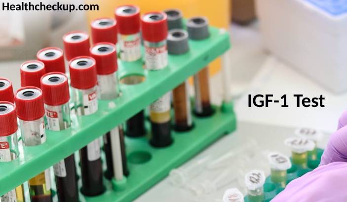 IGF-1 (Insulin-like Growth Factor 1) Test: Purpose, Preparation, Procedure