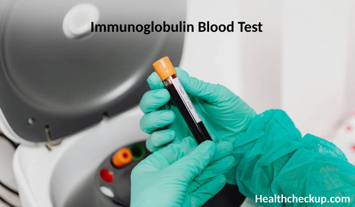 Immunoglobulin Blood Test: Purpose, Preparation, Procedure, Normal Range, Results