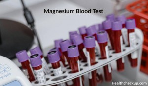 Magnesium Blood Test: Purpose, Preparation, Procedure