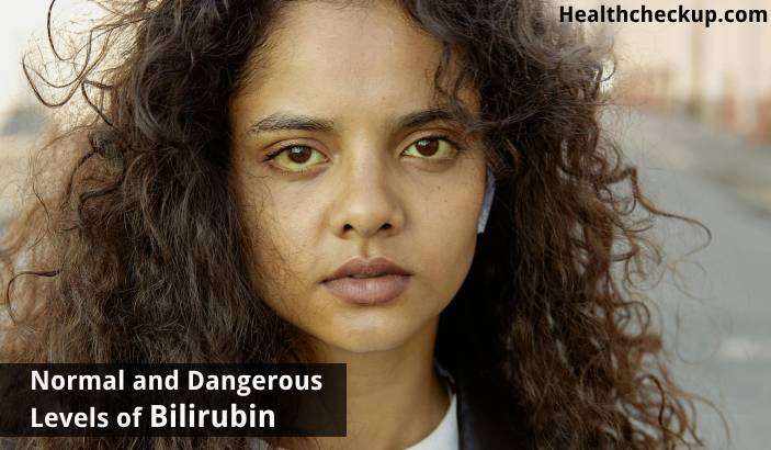What is a dangerous level of bilirubin in adults