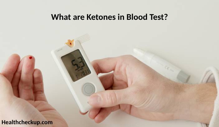 Ketones in Blood: Test Purpose, Preparation, Procedure, Results, and Risks