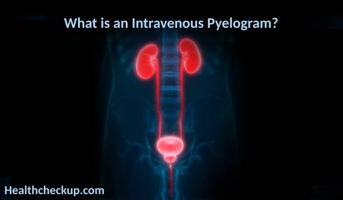 Intravenous Pyelogram (IVP): Purpose, Preparation, Procedure, Results, and Risks