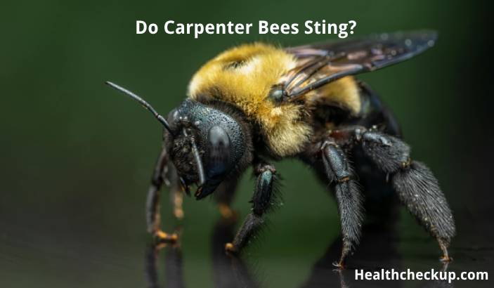 Do Carpenter Bees Sting? Possible Symptoms, Diagnosis, and Treatment