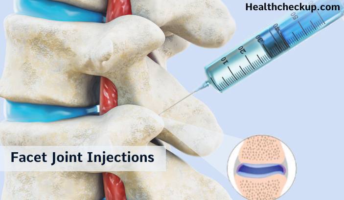 Facet Joint Injections - Types, How long do they Last? Success Rate, Side Effects