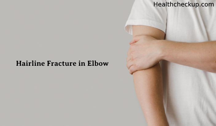 Hairline Fracture in Elbow