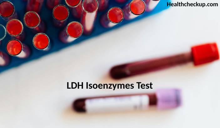 Lactate Dehydrogenase (LDH) Isoenzymes Test: Purpose, Preparation, Procedure, Results